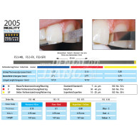 Serrated Diamond Finishing Strips
