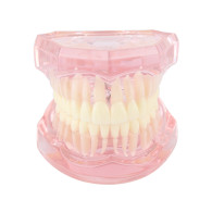 [재고확인후 주문] MX030 치근이 보이는 투명모델