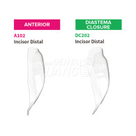 [재고문의] Bioclear Anterior Matrix Refill