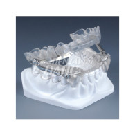 [단종] Dental Sleep Medicine (IST-Appliance) + (Fixing Elements)